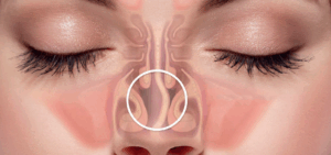 septo nasal.png