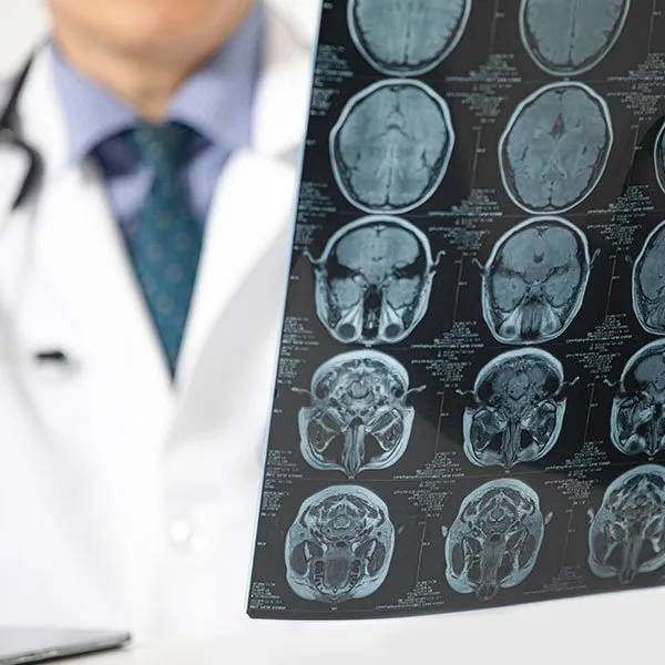 neural imagem 02 1920w