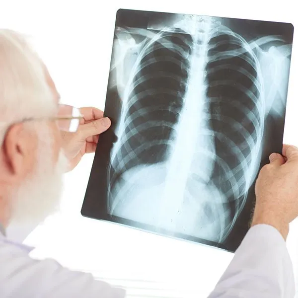 pneumo imagem 02 1920w